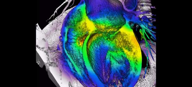 Una instantánea del corazón