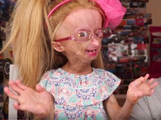 Adalia Rose