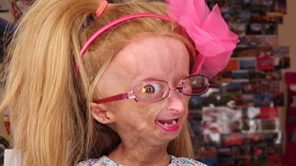 Adalia Rose Adalia Rose