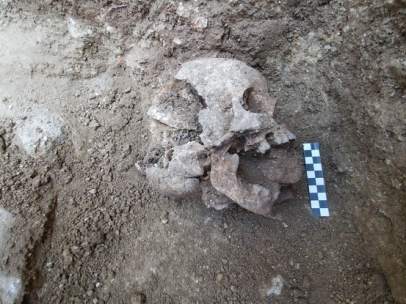 El niño 'vampiro de Lugnano'