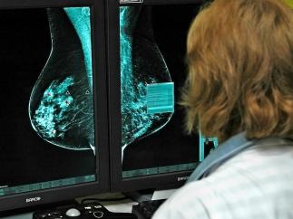 Investigación sobre el cáncer de mama