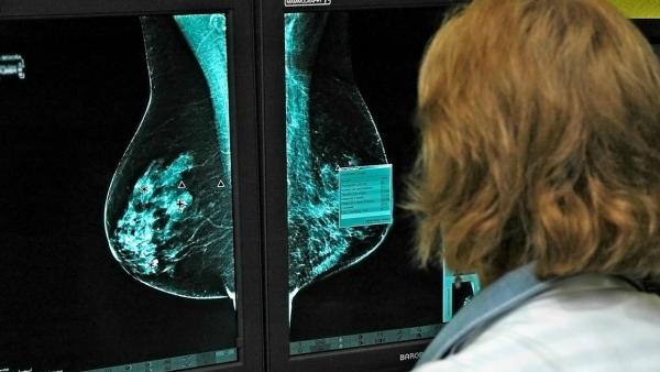 Investigación sobre el cáncer de mama Investigación sobre el cáncer de mama