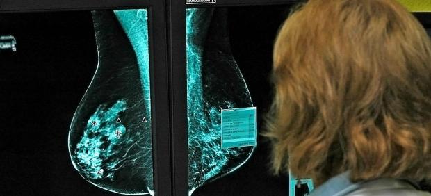 Cáncer de mama