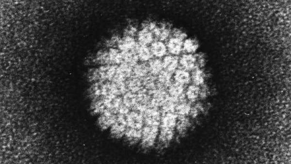 El 75% de la población sexualmente activa ha tenido contacto con el virus del papiloma en algún momento su vida, según la Comunidad. El 75% de la población sexualmente activa ha tenido contacto con el virus del papiloma en algún momento su vida, según la Comunidad.