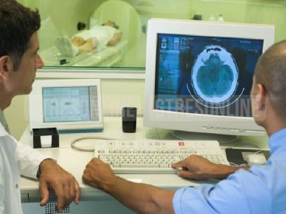 Médicos observando escáner cerebral