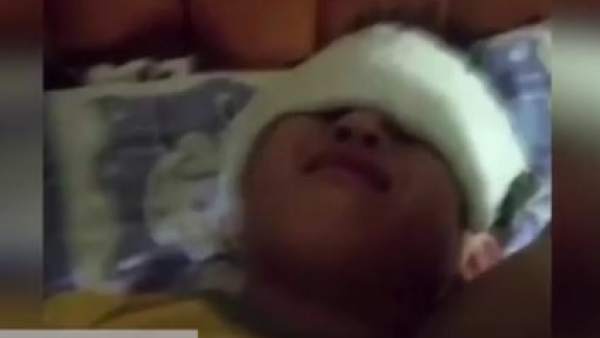 Niños heridos por UV Niños heridos por UV