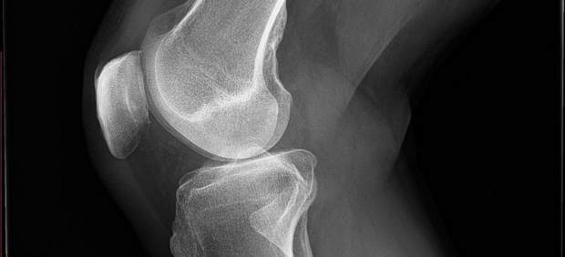 Rodilla