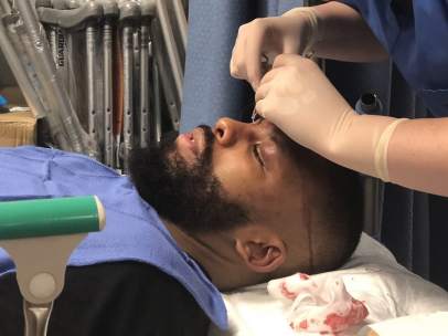 Badou Jack
