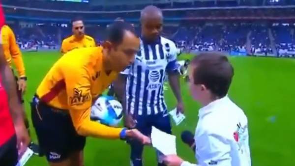 Niño con síndrome de Down Niño con síndrome de Down