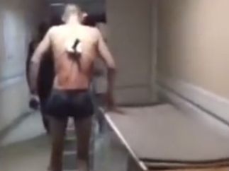 Un paciente con un cuchillo clavado en la espalda