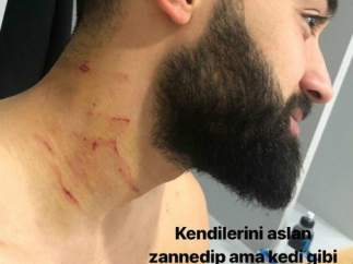 Ferhat Yazgan