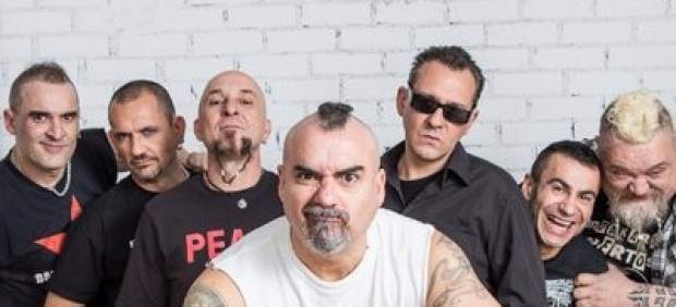 SKA-P
