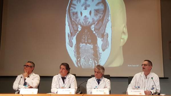 Cirugía láser para la epilepsia Cirugía láser para la epilepsia