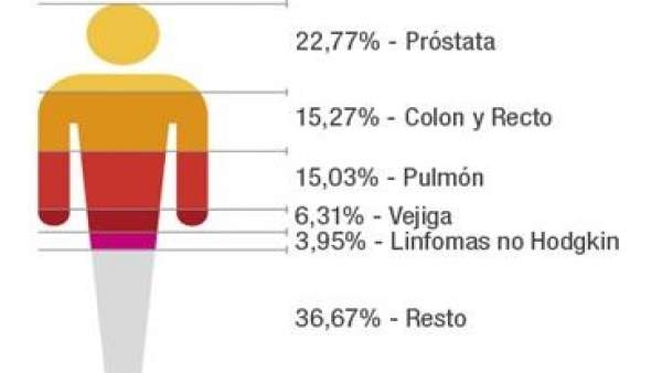 Canarias registra cerca de 11.400 casos de cáncer en 2018, más de la mitad en ho Canarias registra cerca de 11.400 casos de cáncer en 2018, más de la mitad en ho