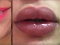 El antes y el después de unos labios con silicona