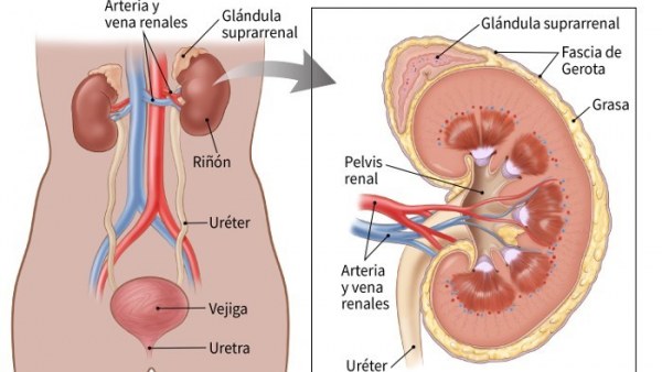 RiÃ±Ã³n afectado por sarcoma