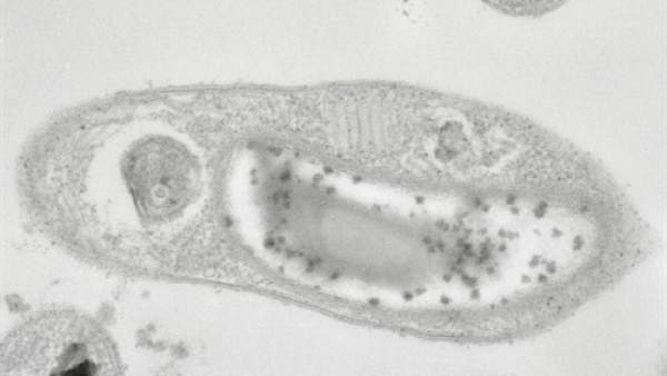 Bacteria Desulforudis audaxviator. Bacteria Desulforudis audaxviator.