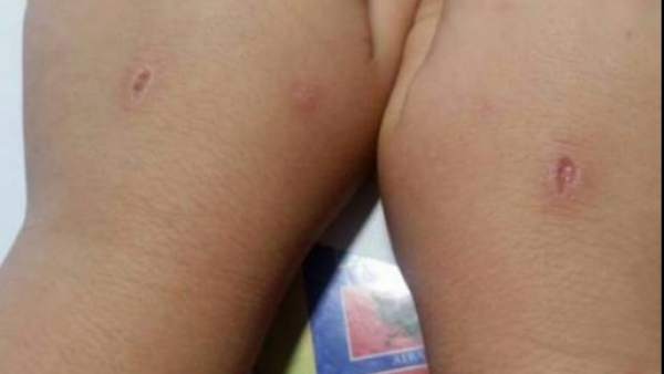 Manos de un niño después de participar en el juego del 'Abecedario del diablo'. Manos de un niño después de participar en el juego del 'Abecedario del diablo'.