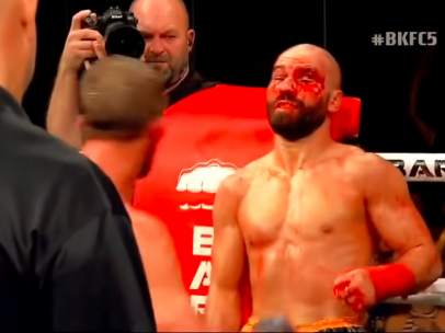 Lobov, ensangrentado