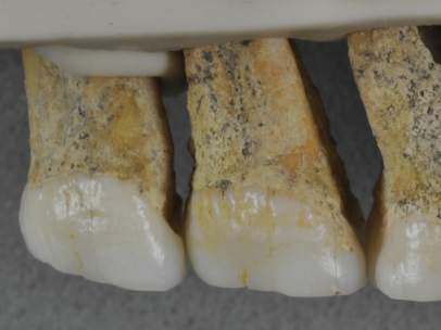 Dentadura superior derecha de 'Homo luzonensi'.