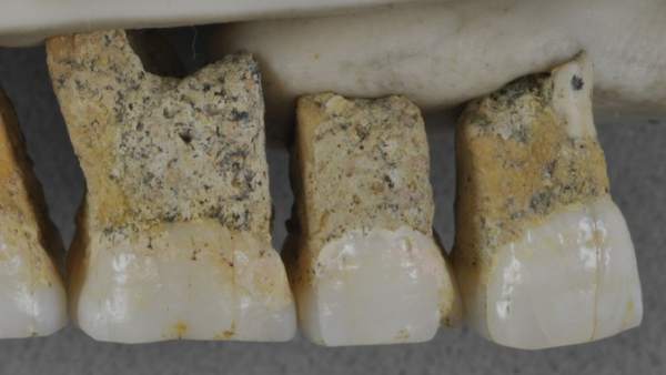 Dentadura superior derecha de 'Homo luzonensi'. Dentadura superior derecha de 'Homo luzonensi'.