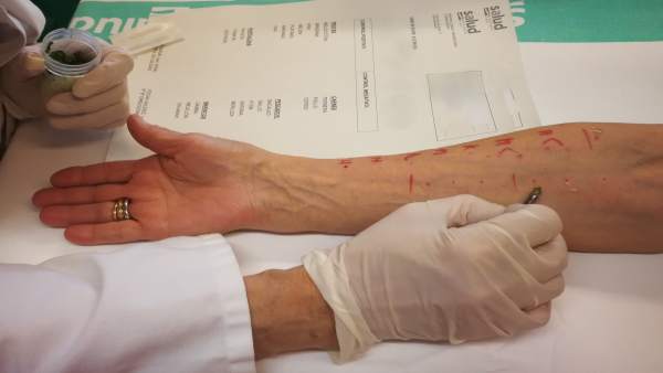 Zaragoza.- El Hospital Clínico y el programa PROA diseñan un protocolo para pacientes alérgicos a la penicilina Zaragoza.- El Hospital Clínico y el programa PROA diseñan un protocolo para pacientes alérgicos a la penicilina