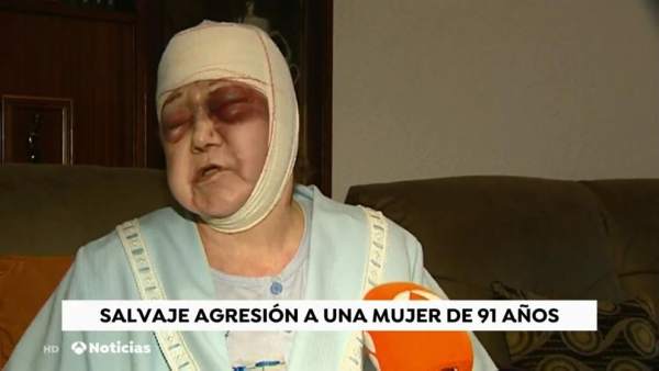 mujer agredida mujer agredida