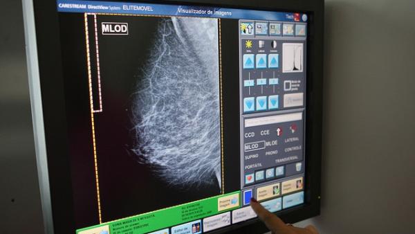 Toledo alberga una cita científica de referencia en cáncer de mama para debatir sobre sus últimos avances Toledo alberga una cita científica de referencia en cáncer de mama para debatir sobre sus últimos avances