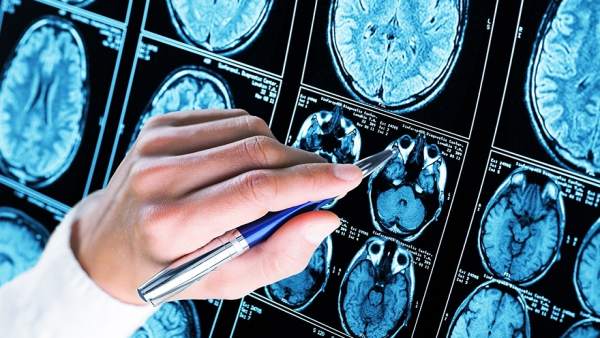Sevilla.- Investigadores de la US logran bloquear una proteína fundamental en el desarrollo del Alzheimer Sevilla.- Investigadores de la US logran bloquear una proteína fundamental en el desarrollo del Alzheimer