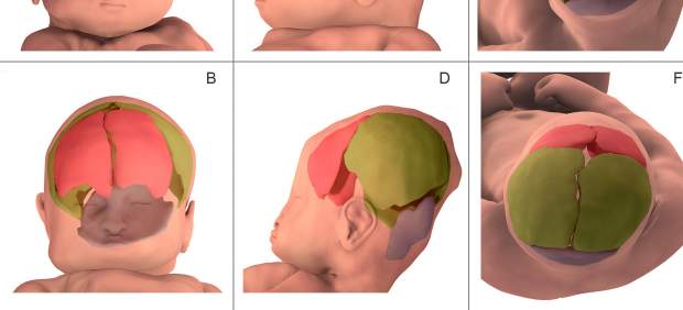 Cráneo fetal