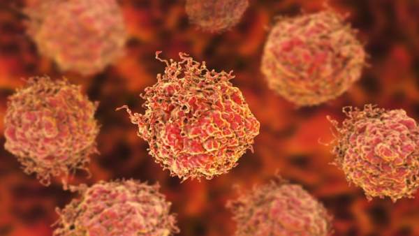 Una dosis única de radioterapia dirigida es segura y eficaz para el cáncer de próstata, según un estudio Una dosis única de radioterapia dirigida es segura y eficaz para el cáncer de próstata, según un estudio