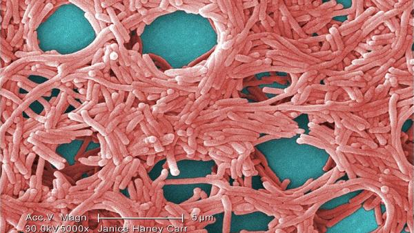 Bacteria Legionella Bacteria Legionella