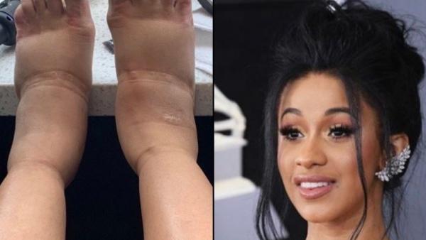 Cardi B Cardi B