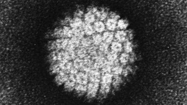 Virus del papiloma humano. Virus del papiloma humano.