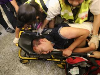 Un herido en las protestas en el aeropuerto de Hong Kong