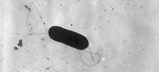 Listeriosis