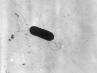 Listeriosis