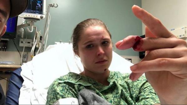 Ronda Rousey sufre la amputación de un dedo Ronda Rousey sufre la amputación de un dedo