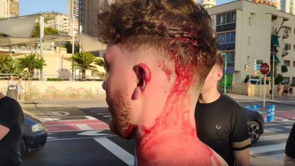 Fotograma del vídeo de la agresión de trileros al turista británico Fotograma del vídeo de la agresión de trileros al turista británico