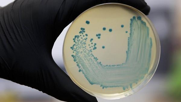 Food Safety Pathogen Listeria Monocytogenes Isolated On Agar From A Food Sample. Food Safety Pathogen Listeria Monocytogenes Isolated On Agar From A Food Sample.
