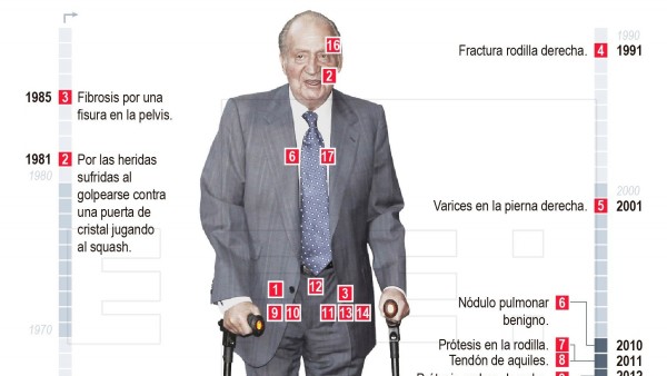 Las 17 operaciones del rey Juan Carlos Las 17 operaciones del rey Juan Carlos