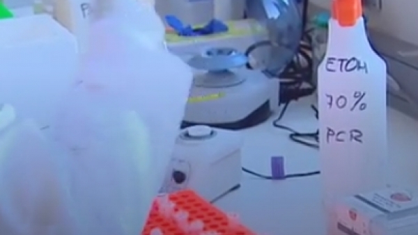 Análisis realizados para detectar listeriosis en afectados Análisis realizados para detectar listeriosis en afectados