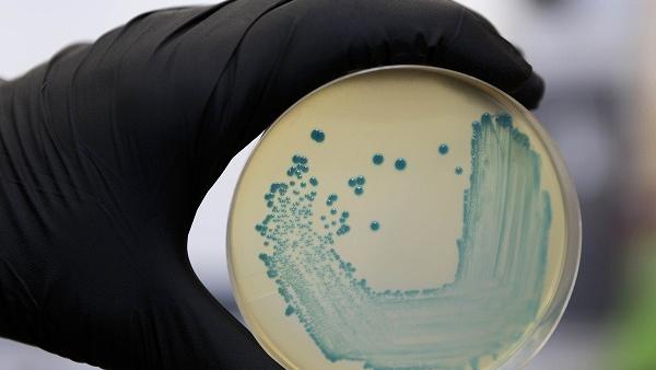 Listeria monocytogenes Listeria monocytogenes