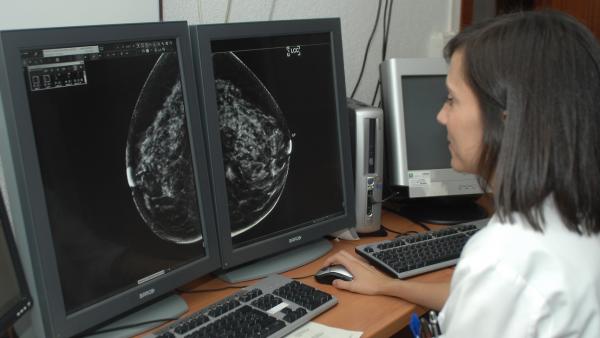 Radiografía de una mamografía. Radiografía de una mamografía.