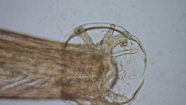 Angiostrongylus cantonensis Angiostrongylus cantonensis