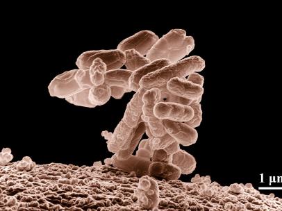 E. Coli