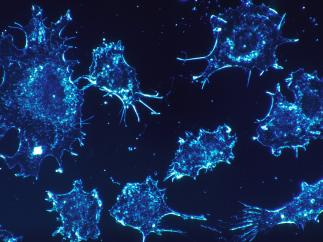 Células cancerígenas